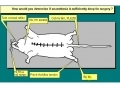 anaesthesia